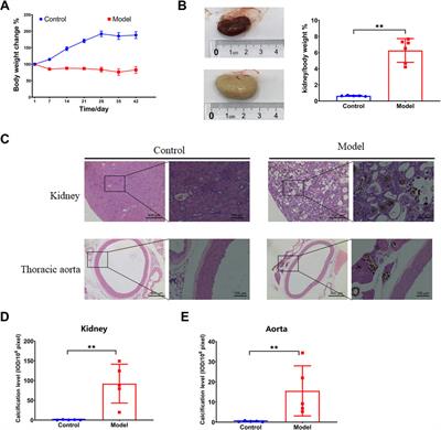 Role of symbiotic microbiota dysbiosis in the progression of chronic kidney disease accompanied with vascular calcification